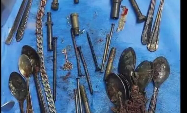 إستخراج 20 معلقة وأمواس ومفاتيح من معدة مريض 30 عاما 1 Screenshot ٢٠٢٤٠١٢٢ ١٣٥٨٥٩